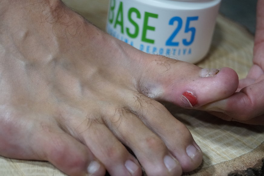 10 sitios donde ponerse vaselina a la hora de correr